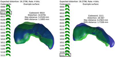 On the Complexity of Human Neuroanatomy at the Millimeter Morphome Scale: Developing Codes and Characterizing Entropy Indexed to Spatial Scale